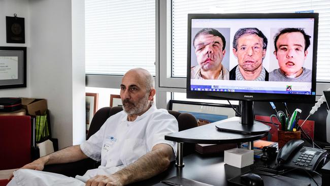 Laurent Lantieri poses next to a screen showing different steps of his patient Jerome Hamon's surgery.