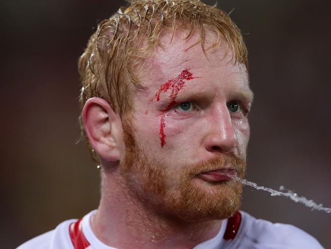 BRISBANE, AUSTRALIA - DECEMBER 02:  James Graham of England spits water during the 2017 Rugby League World Cup Final between the Australian Kangaroos and England at Suncorp Stadium on December 2, 2017 in Brisbane, Australia.  (Photo by Matt King/Getty Images)