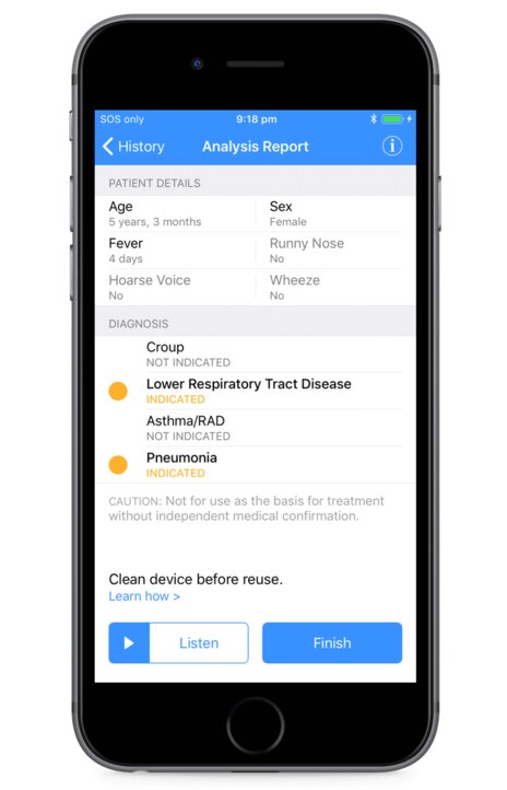 ResApp's Covid-19 cough app failed to reach the sensitivity thresholds required under a takeover from Pfizer.