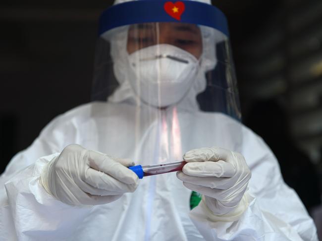 A health worker holds a blood sample taken to test for the COVID-19 coronavirus. Picture: AFP