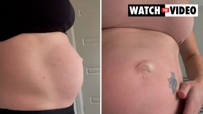 Jana Pittman shares video of postpartum stomach after having twins