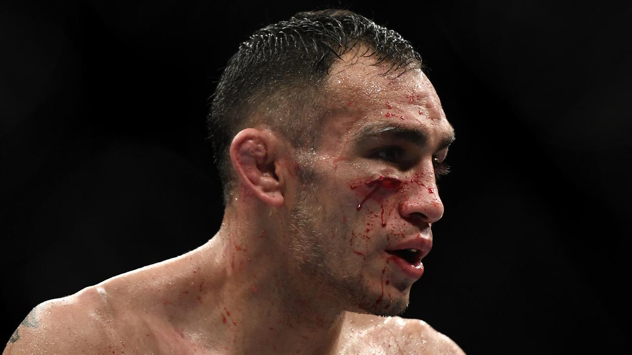 Tony Ferguson was beaten and bruised in the fight. (Photo by Douglas P. DeFelice/Getty Images)