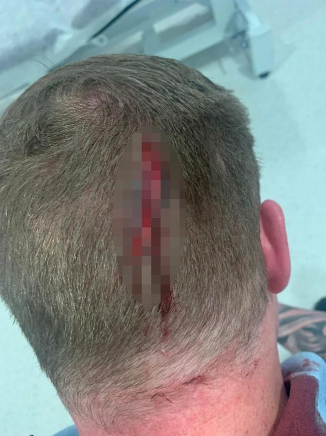 The police officer’s injuries. Picture: NSW Police