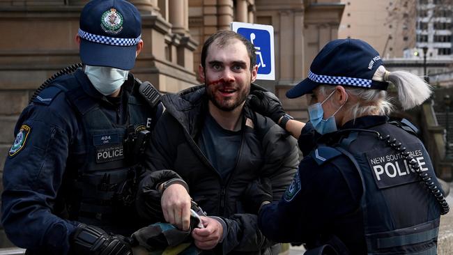 A bloodied protester is led away in handcuffs. Picture: NCA NewsWire/Bianca De Marchi