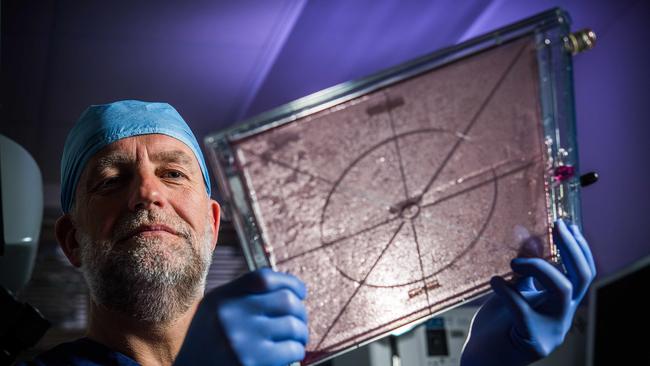 Dr John Greenwood with a cassette containing a composite cultured skin. Picture: TOM HUNTLEY