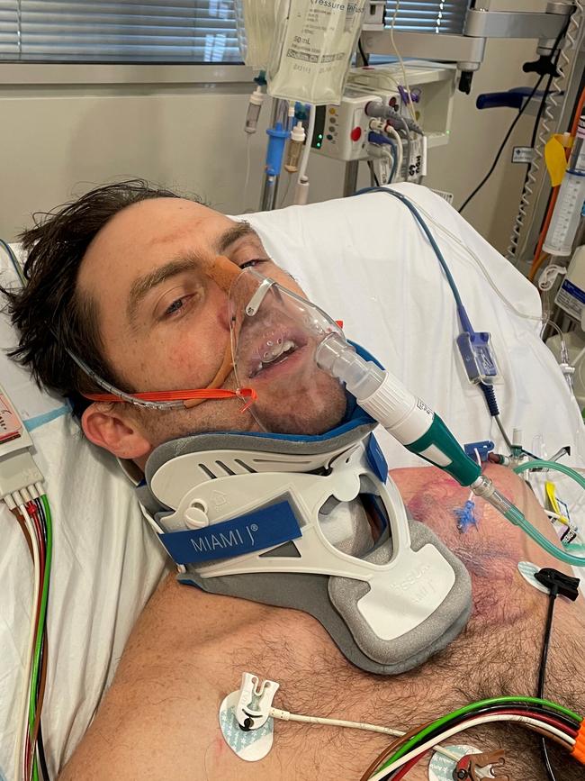 Andrew Regan is hospital after his horrific rugby union injury.