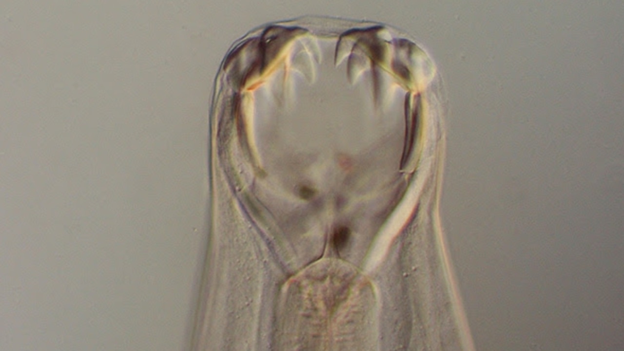 A hookworm viewed under the microscope. Picture: Lyn Knott