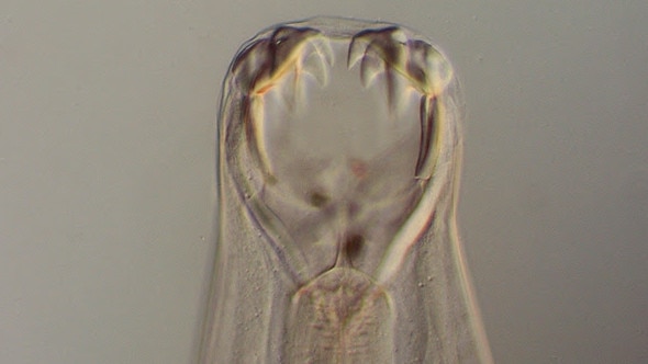 A hookworm viewed under the microscope. Picture: Lyn Knott