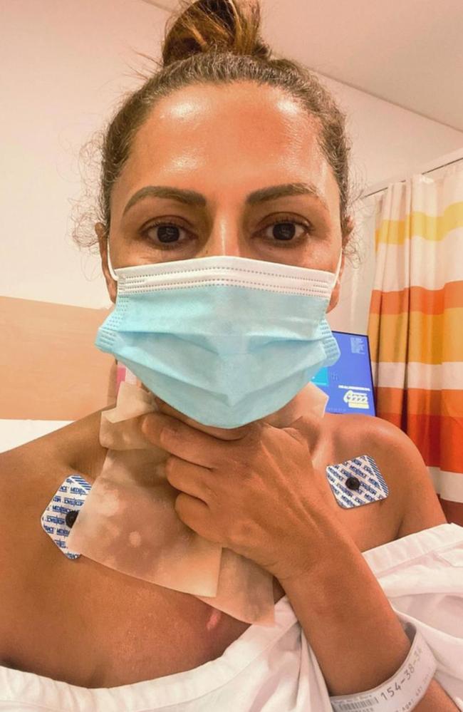 Sally Obermeder revealed she was rushed to hospital with ‘very deep burns’. Picture: Instagram.