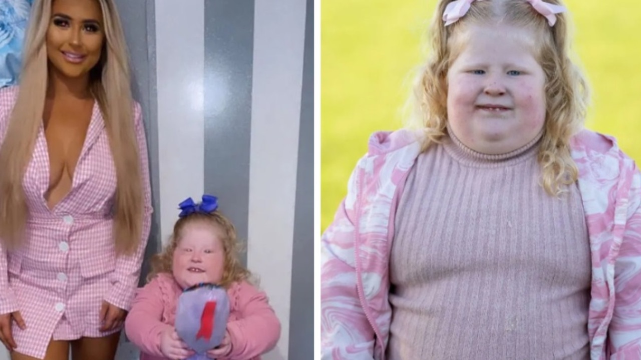 A five-year-old girl weighs 44kg due to a rare condition that constantly leaves her hungry for more food. Picture: Caters News Agency