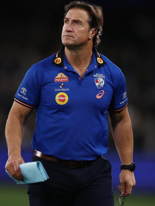 Luke Beveridge pre-broken hand. Photo by Michael Klein.