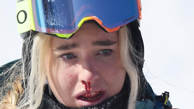 PYEONGCHANG-GUN, SOUTH KOREA - FEBRUARY 13:  Blood is seen from the nose and mouth of Emily Arthur of Australia after crashing during the Snowboard Ladies' Halfpipe Final on day four of the PyeongChang 2018 Winter Olympic Games at Phoenix Snow Park on February 13, 2018 in Pyeongchang-gun, South Korea.  (Photo by David Ramos/Getty Images)