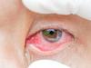 Man doused in ‘kerosene’ in shocking attack