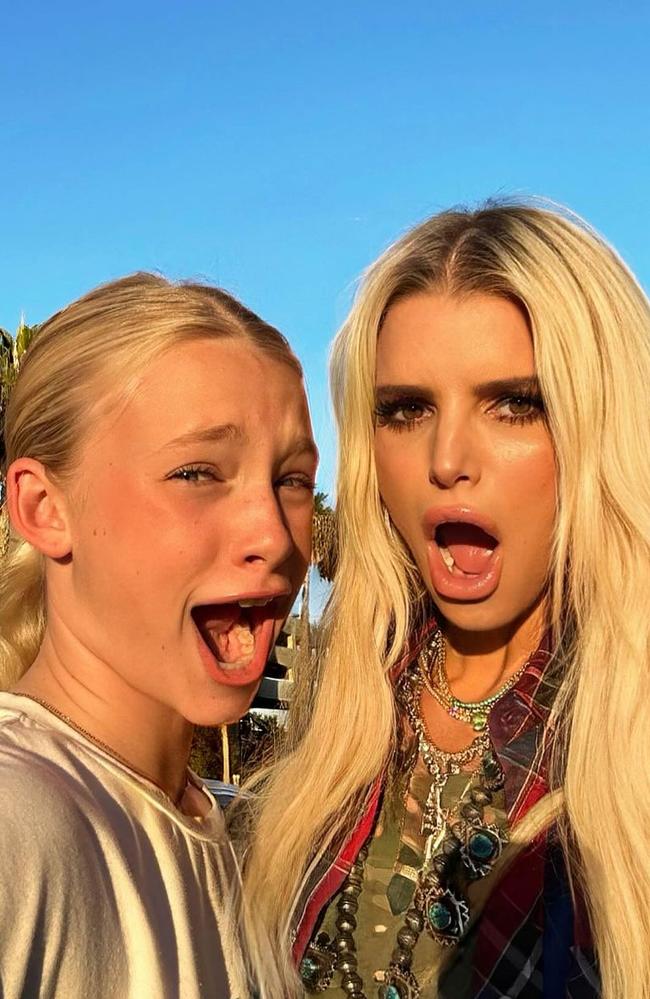 Jessica Simpson and her mother twin with bright-red lips - ABC News