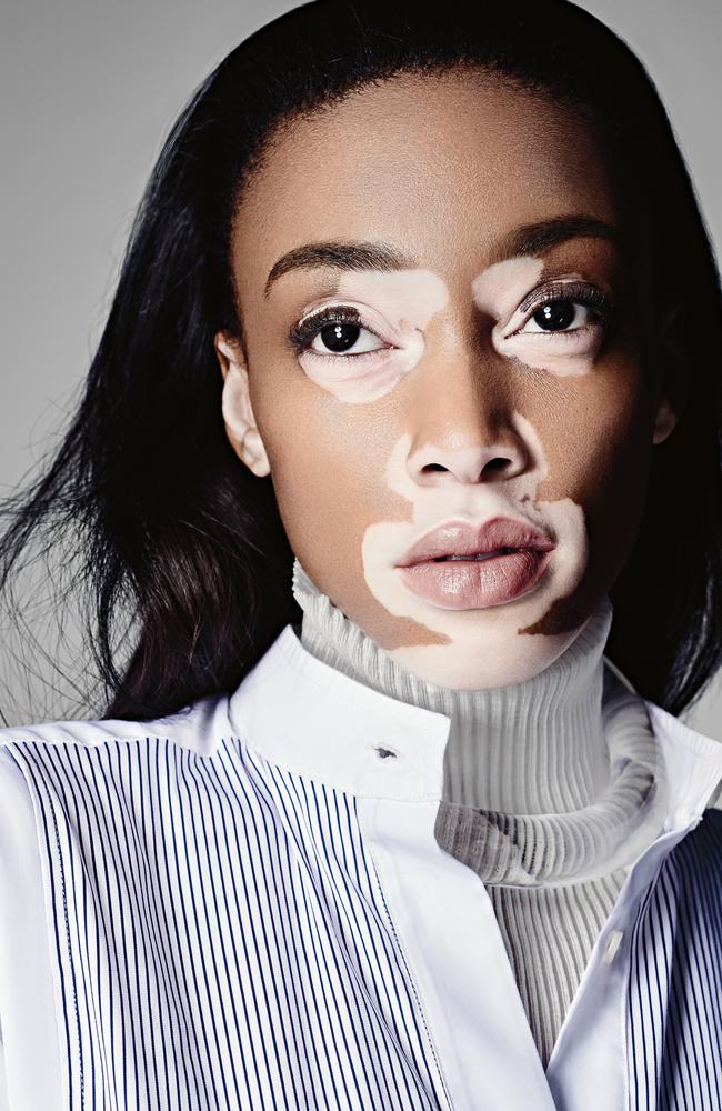 Winnie Harlow. Picture: Daemian Smith & Christine Suarez