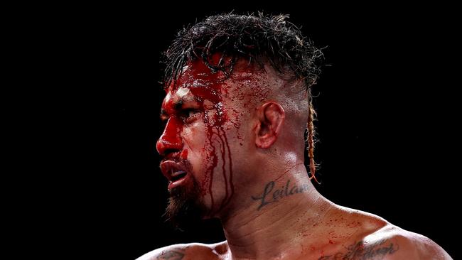 Hunter Ioane suffered a nasty cut above his eye in his fight with Darragh Foley. Picture: Brendon Thorne/Getty Images