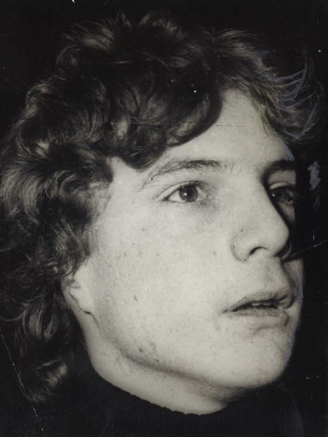 Seventeen-year-old John Paul Getty III after his release in December 1973. His captors severed his right ear to show proof of life.