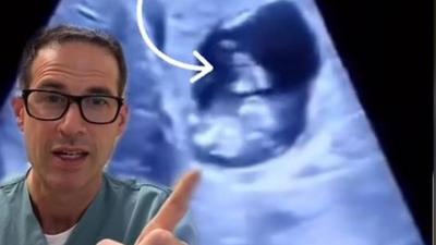 Paediatrician shares rare ectopic pregnancy