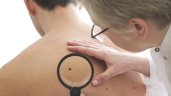 Dermatologist examines a mole of male patient