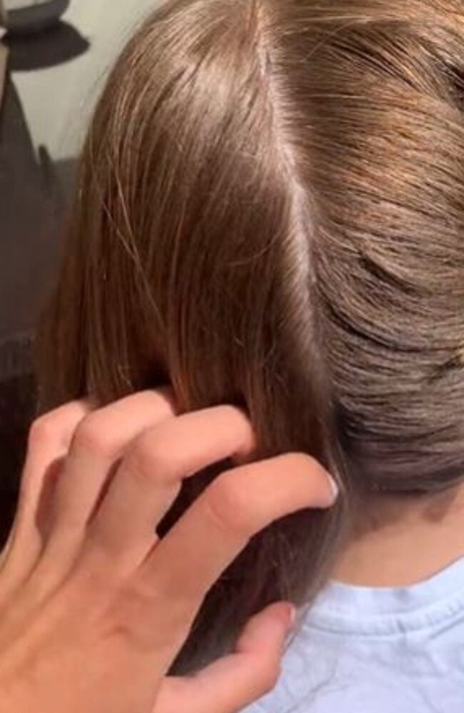 Rachel is a lice removal technician, and showed a young girl's hair during treatment. Picture: @liceladyrachel