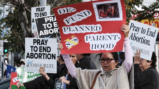 There are also those who truly believe in the sanctity of life from the moment of conception.   Picture: AP/Richard Vogel