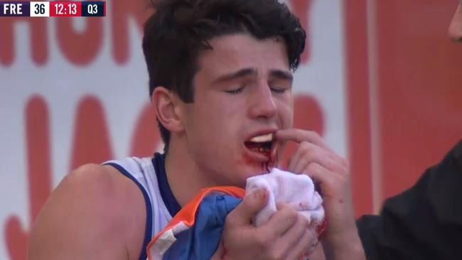 Fremantle Docker Andrew Brayshaw points to his teeth after being hit by Andrew Gaff.