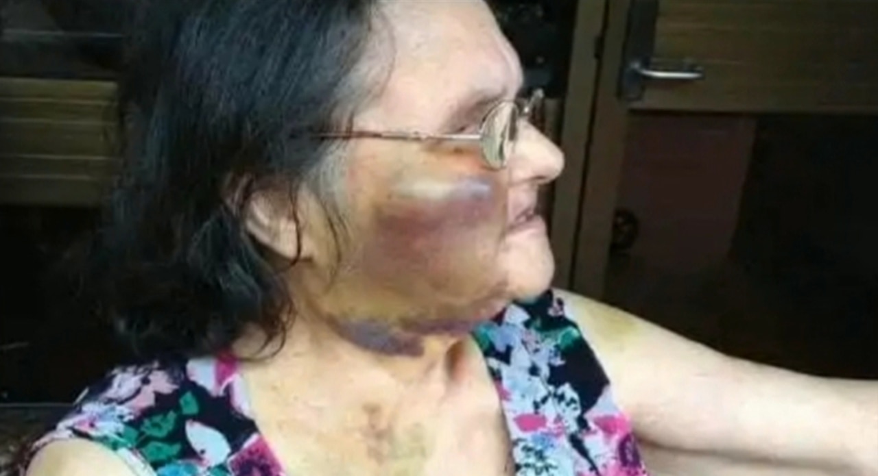 Aged care worker found guilty of bashing Adelaide dementia patient