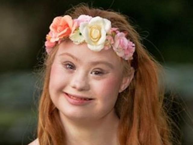 Model with Down syndrome lands huge gig