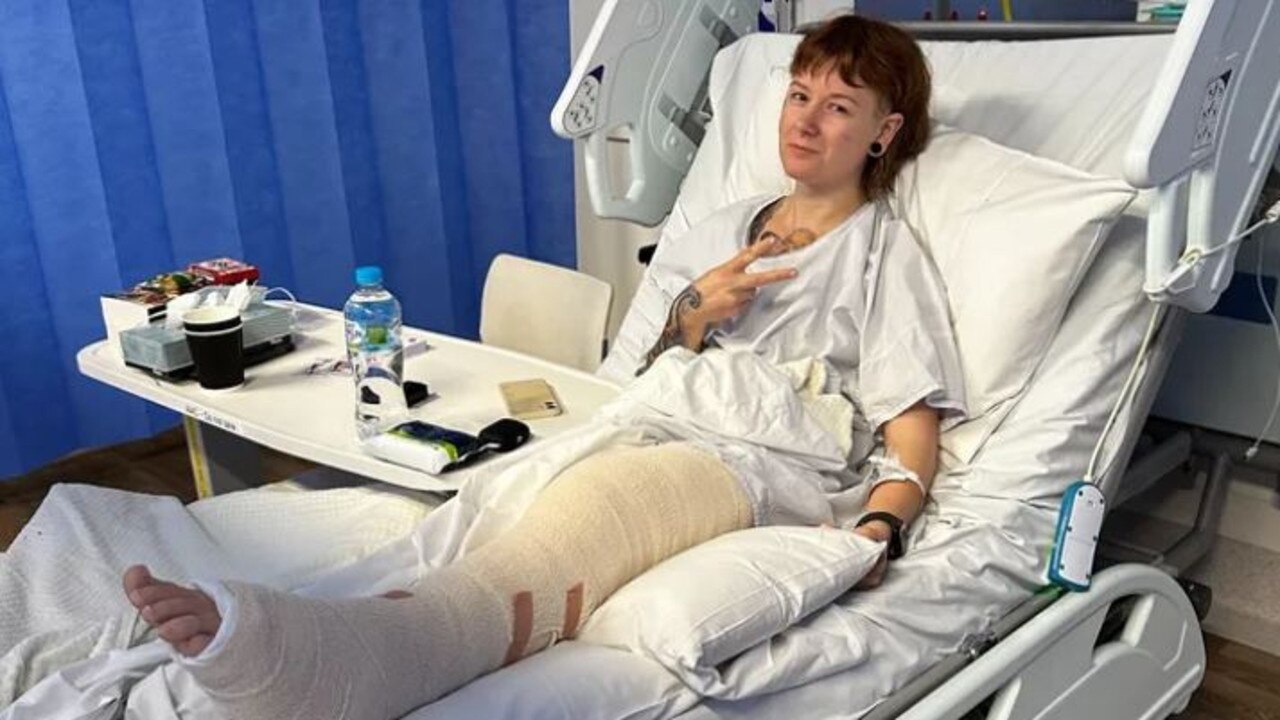 Anna Frances-Wood was hit by a falling tree branch at Keith Stephenson Park in Mount Barker. Picture: Supplied