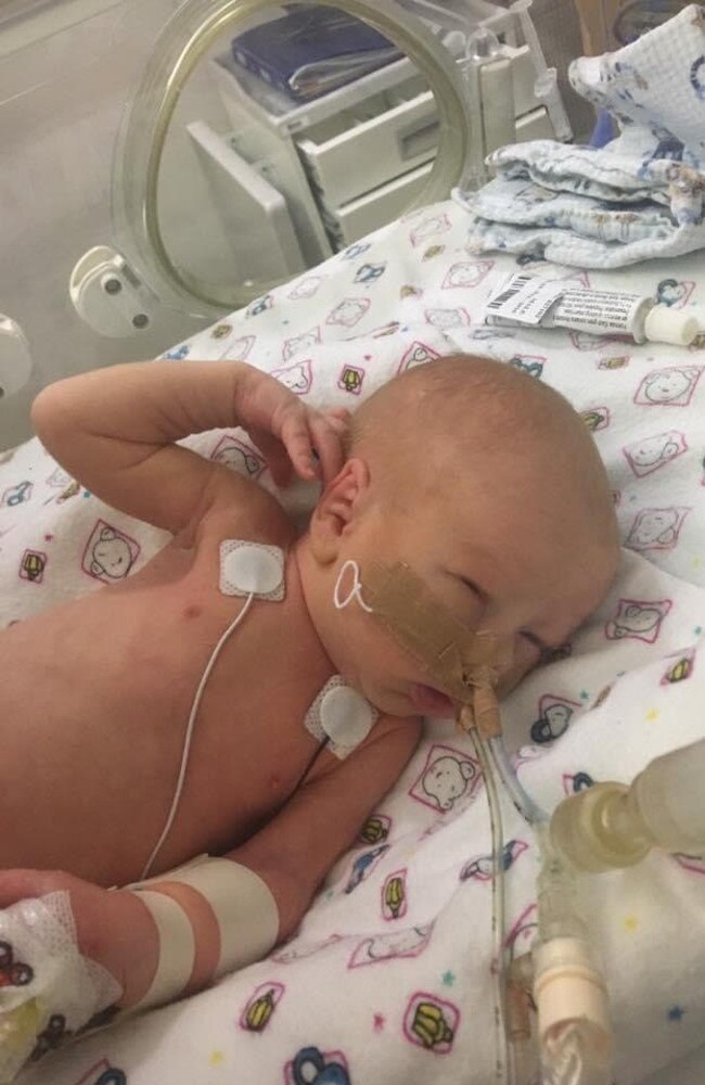 Beaconsfield baby Lucas Baker did not just surprise his parents by arriving six weeks early – the biggest shock came 10 days later when he was diagnosed with viral meningitis. Picture: Contributed