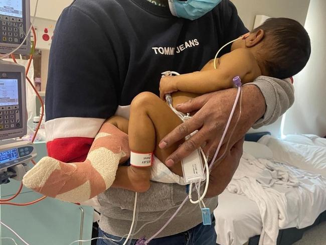 Newborn baby Jhanvi before getting her liver transplant. Picture: Supplied / DonateLife Victoria