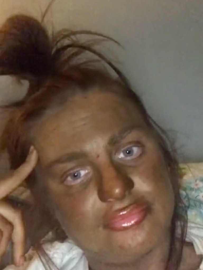 Tiktok Jodie Morris And Her St Moritz Fake Tan Fail Au — Australia S Leading News Site