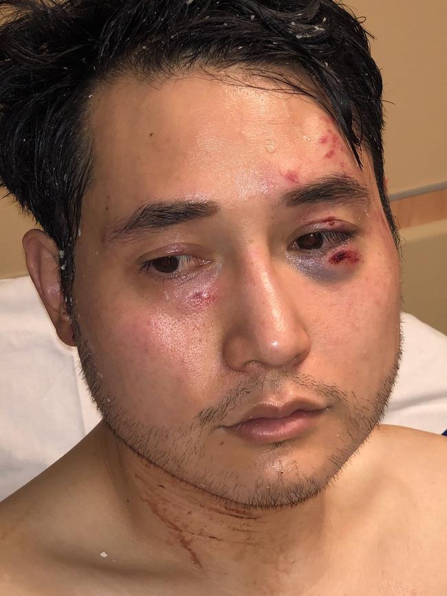 Journalist Andy Ngo was attacked at an Antifa protest in Portland, Oregon.