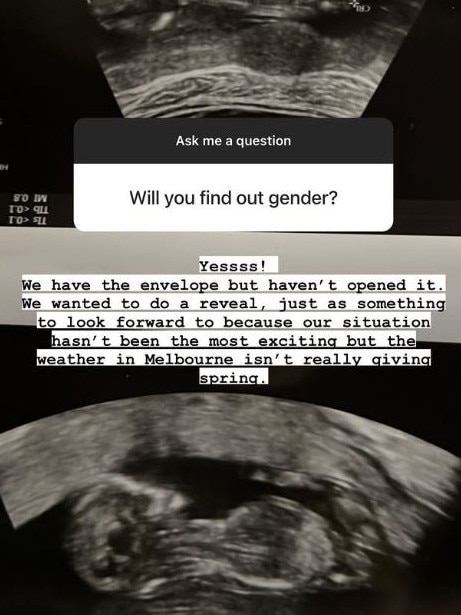 She shared that the couple intend to ‘do a [gender] reveal, just as something to look forward to’. Picture: Instagram