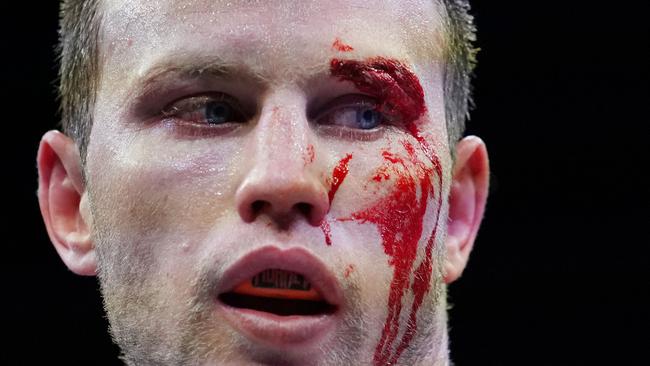 Australian boxer Jeff Horn looks on with a bloodied face against Michael Zerafa during the 'Battle of Bendigo' bout at the Bendigo Stadium in Bendigo, Saturday, August 31, 2019. (AAP Image/Michael Dodge) NO ARCHIVING, EDITORIAL USE ONLY