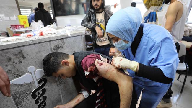 A wounded man receives treatment in Gaza City's Al-Shifa hospital. Picture: AFP