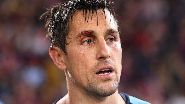 Will Mitchell Pearce come back for more Origin pain? (AAP Image/Dave Hunt)