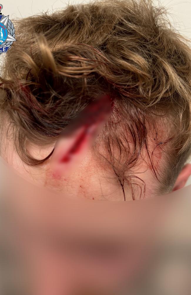 The 24-year-old was taken to hospital with a deep cut to his forehead. Picture: WA Police