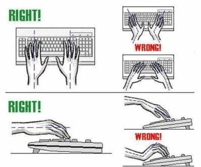 Typing is a key risk factor for the development of carpal tunnel syndrome. Have a look at these illustrations and the importance of hand position and prevent carpal tunnel from affecting you. Picture: Rowan Hunnam