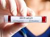 New Covid fatality recorded in NT