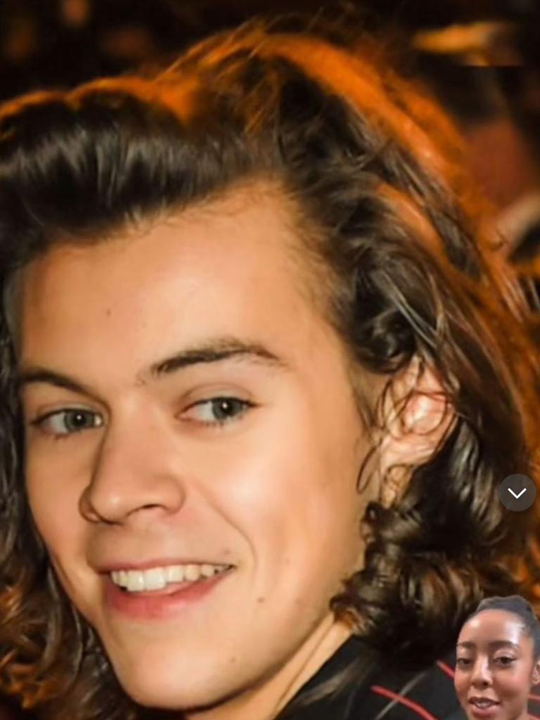 A TikToker claims that Harry Styles has had a hair transplant. Picture: TikTok/@georgiejxme