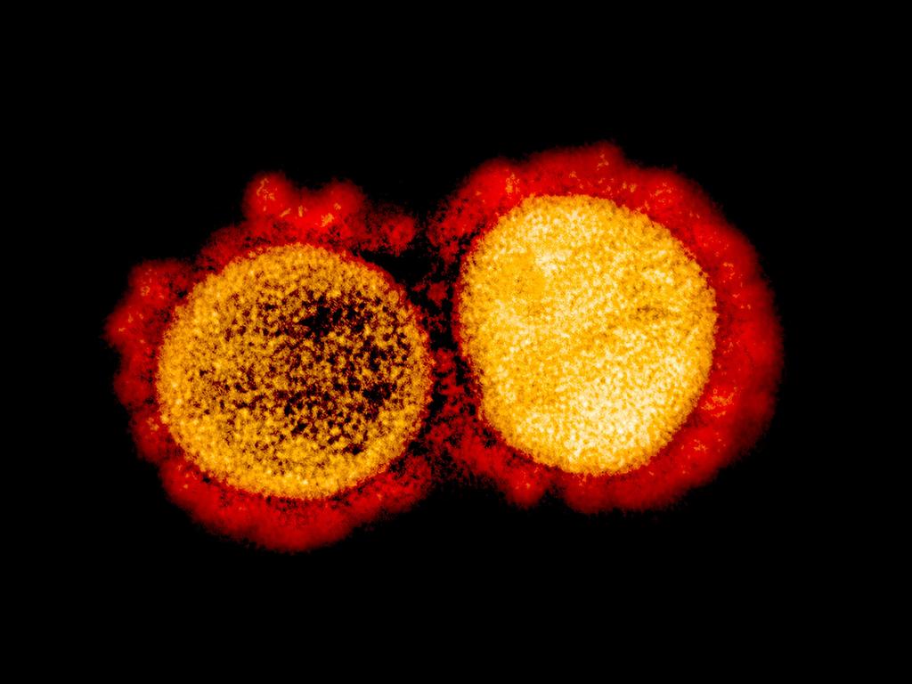 (FILES) In this file undated handout image obtained August 11, 2020, courtesy of the National Institute of Allergy and Infectious Diseases(NIH/NIAID), shows a transmission electron micrograph of SARS-CoV-2 virus particles, isolated from a patient,captured and color-enhanced at the NIAID Integrated Research Facility (IRF) in Fort Detrick, Maryland. - The US biotech firm Eli Lilly on October 7, 2020 announced it was seeking an emergency use authorization (EUA) for its lab-produced antibody treatments against Covid-19, after early trial results showed they reduced viral load, symptoms and hospitalization rates.Our teams have worked tirelessly the last seven months to discover and develop these potential antibody treatments, said Daniel Skovronsky, Lilly's chief scientific officer. (Photo by Handout / National Institute of Allergy and Infectious Diseases / AFP) / RESTRICTED TO EDITORIAL USE - MANDATORY CREDIT AFP PHOTO /NATIONAL INSTITUTE OF ALLERGY AND INFECTIOUS DISEASES/HANDOUT  - NO MARKETING - NO ADVERTISING CAMPAIGNS - DISTRIBUTED AS A SERVICE TO CLIENTS