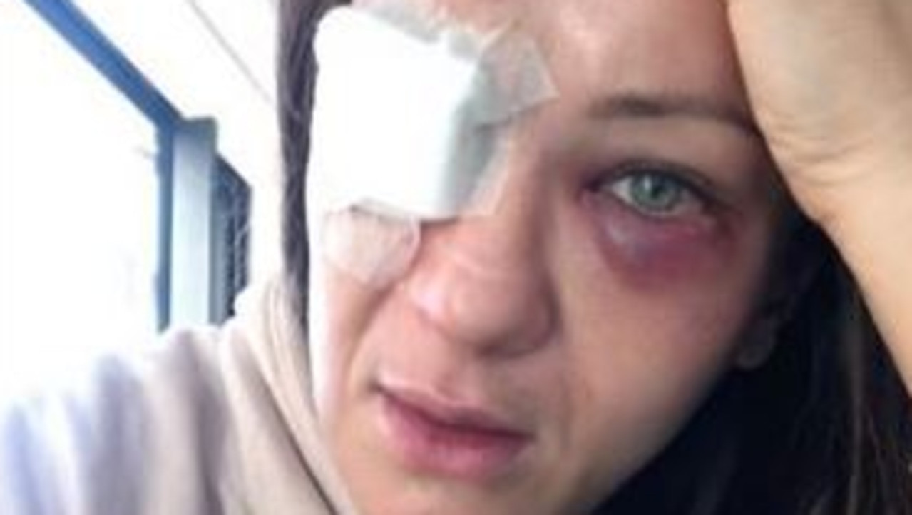 Karolina Kowalkiewicz suffered horrific injuries in her last fight.