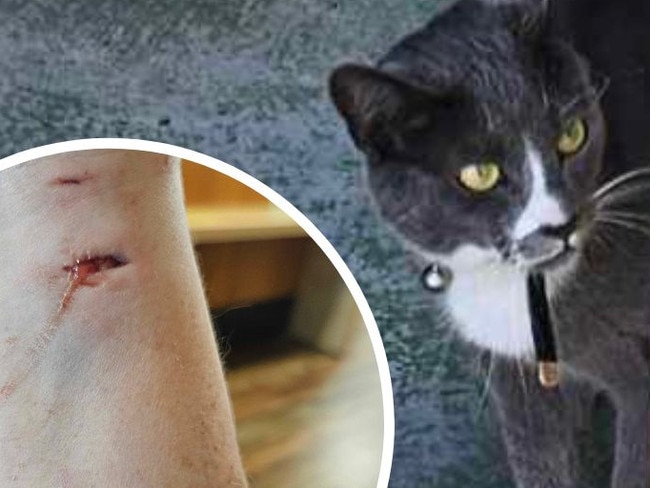 Elizabeth Downs woman, Michelle Johnstone attacked by own cat Matty and hospitalised.