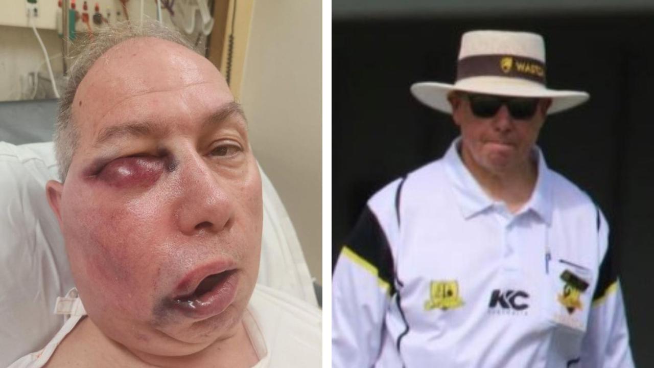 Umpire’s gruesome injury after ‘brutal blow’