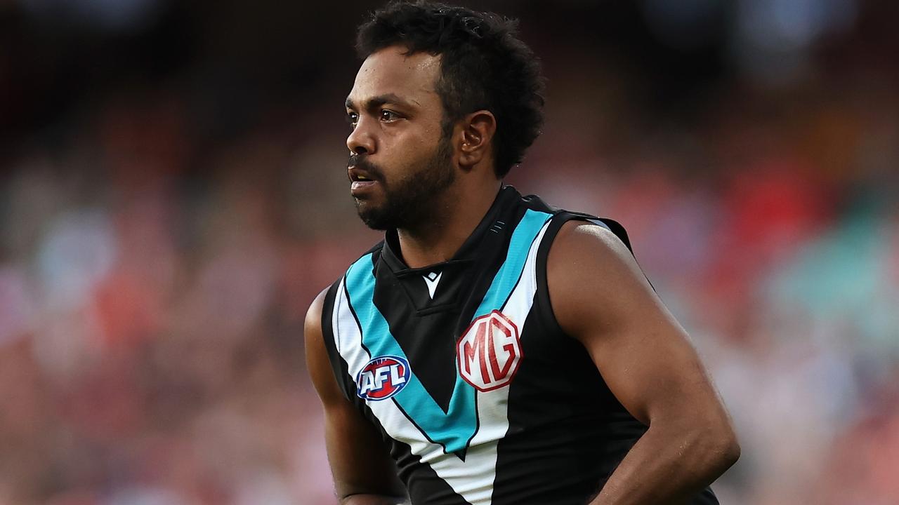 Cornes: The modern footballer has the resilience of a wet tissue