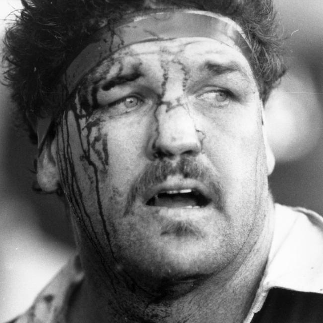 Greg Dowling bloodied while playing for Queensland.