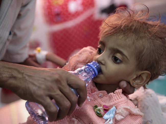 In this Thursday, Sept. 27, 2018 photo, a father gives water to his malnourished daughter at a feeding center in a hospital in Hodeida, Yemen. With US backing, the United Arab Emirates and its Yemeni allies have restarted their all-out assault on Yemenâ€™s port city of Hodeida, aiming to wrest it from rebel hands. Victory here could be a turning point in the 3-year-old civil war, but it could also push the country into outright famine. Already, the fighting has been a catastrophe for civilians on the Red Sea coast. (AP Photo/Hani Mohammed)