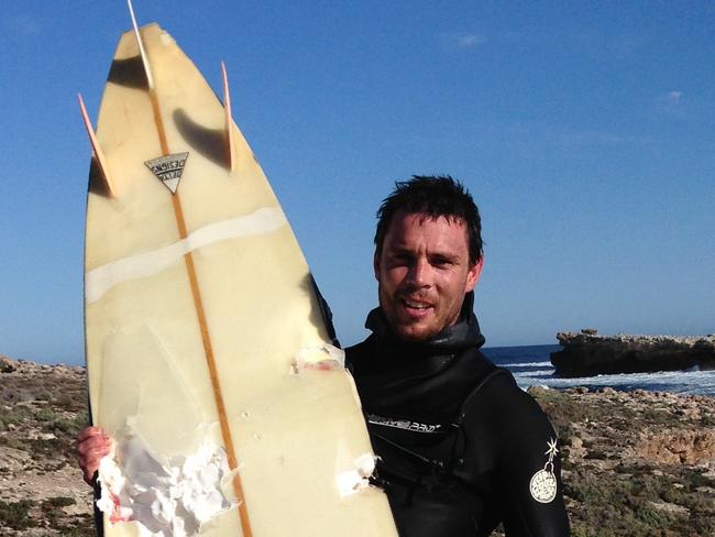 Elliston shark attack victim Andrew “Monkey” McLeod with his damaged board.