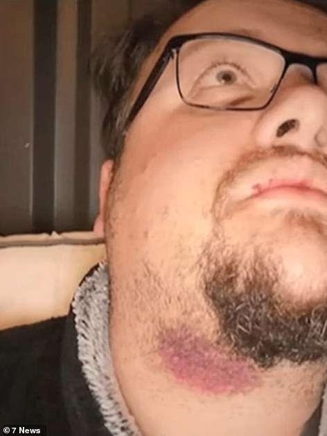 TV producer Ryan Naumenko with injuries to his neck.